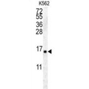 Histone H2A Type 2-A (HIST2H2AA4) Antibody