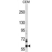 NADPH Oxidase 5 (NOX5) Antibody