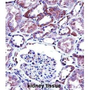 Transient Receptor Potential Cation Channel Subfamily V Member 1 (TRPV1) Antibody