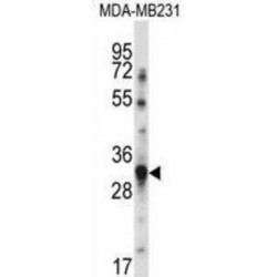 Tumor Necrosis Factor Ligand Superfamily Member 13B / BAFF (TNFSF13B) Antibody