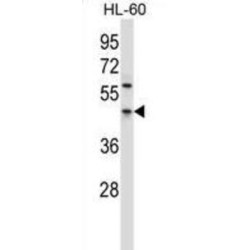 Programmed Cell Death Protein 4 (PDCD4) Antibody