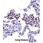 Toll Like Receptor 8 (TLR8) Antibody