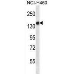 Toll Like Receptor 8 (TLR8) Antibody
