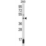 Suppressor of Variegation 3-9 Homolog 1 (SUV39H1) Antibody
