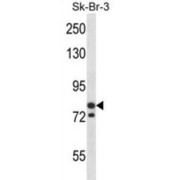 Minichromosome Maintenance Deficient 3 (MCM3) Antibody