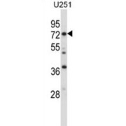 Radixin (RDX) Antibody