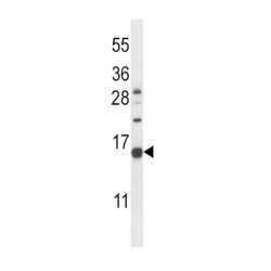 C-Type Natriuretic Peptide (NPPC) Antibody