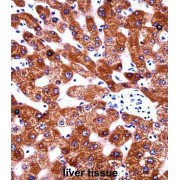 Cytochrome B5 Type A (CYB5A) Antibody