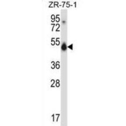 CUGBP Elav-Like Family Member 1 (CUGBP1) Antibody
