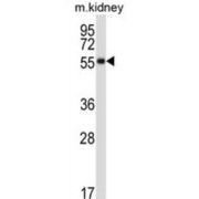 abx027756