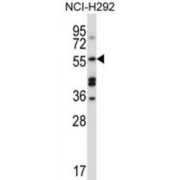 Sorting Nexin 1 (SNX1) Antibody