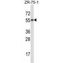 RAR Related Orphan Receptor Beta (RORB) Antibody