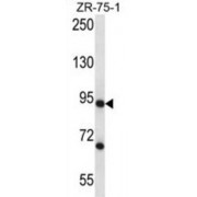 Cleavage Stimulation Factor Subunit 3 (CSTF3) Antibody