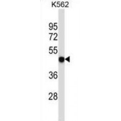 Purinergic Receptor P2X 5 (P2RX5) Antibody