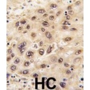 Nucleostemin (NS) Antibody
