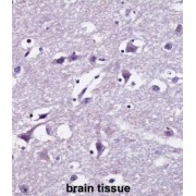 SEC22 Vesicle Trafficking Protein-Like 1 (SEC22B) Antibody