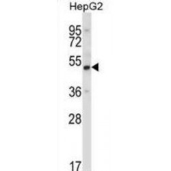 Upstream-Binding Protein 1 (UBP1) Antibody