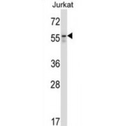 Western blot analysis of Jurkat cell line lysates (35 µg/lane) using Beclin-1 antibody.