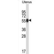 Carboxypeptidase O (CPO) Antibody