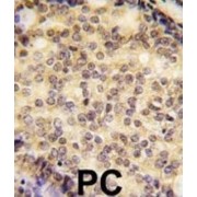 Transcription Factor SOX-9 (SOX9) Antibody