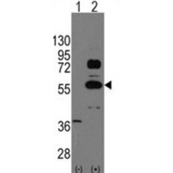 Transcription Factor SOX-9 (SOX9) Antibody