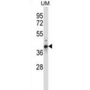 Out At First Protein Homolog (OAF) Antibody