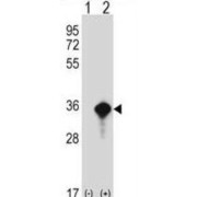Amino-Terminal Enhancer of Split (AES) Antibody
