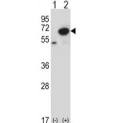 Bifunctional Polynucleotide Phosphatase/kinase (PNKP) Antibody