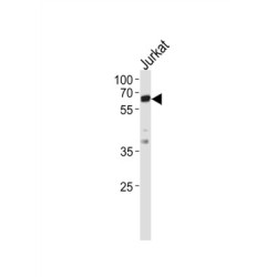 Tyrosine-Protein Kinase ZAP-70 (ZAP70) Antibody