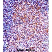 Tyrosine-Protein Kinase ZAP-70 (ZAP70) Antibody