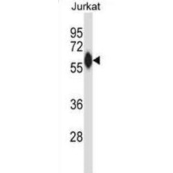 Tyrosine-Protein Kinase ZAP-70 (ZAP70) Antibody