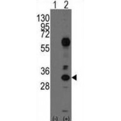 T-Cell Surface Glycoprotein CD8 Alpha Chain (CD8A) Antibody