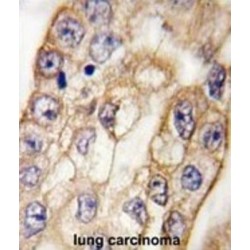 T-Cell Surface Glycoprotein CD8 Alpha Chain (CD8A) Antibody