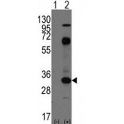 T-Cell Surface Glycoprotein CD8 Alpha Chain (CD8A) Antibody