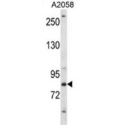 CREB-Regulated Transcription Coactivator 2 (CRTC2) Antibody