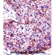 Keratin 6C (KRT6C) Antibody