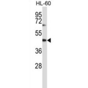 Cytohesin 1 (CYTH1) Antibody