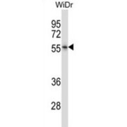 Photoreceptor Cell Specific Nuclear Receptor / PNR (NR2E3) Antibody