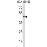 abx027885