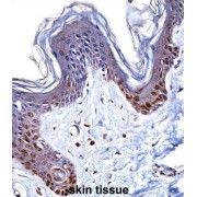 Non-Histone Chromosomal Protein HMG-14 (HMGN1) Antibody