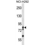 Gamma-Adducin (ADD3) Antibody