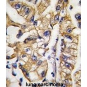 Huntington Disease Gene Regulatory Region-Binding Protein 1 (HDBP1) Antibody