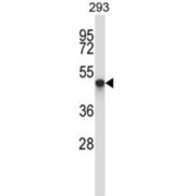 TOM1-Like Protein 1 (TOM1L1) Antibody