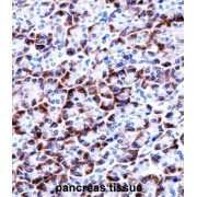 Coiled-Coil Domain Containing 50 (CCDC50) Antibody
