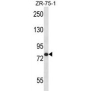 abx027906