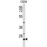 Lck-Interacting Transmembrane Adapter 1 (LIME1) Antibody