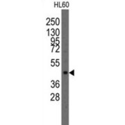 LIM Homeobox Transcription Factor 1-Alpha (Lmx1a) Antibody