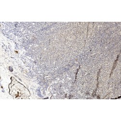 Mixed Lineage Kinase Domain-Like Protein (MLKL) Antibody