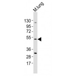 Mixed Lineage Kinase Domain-Like Protein (MLKL) Antibody