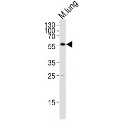 Mixed Lineage Kinase Domain-Like Protein (MLKL) Antibody